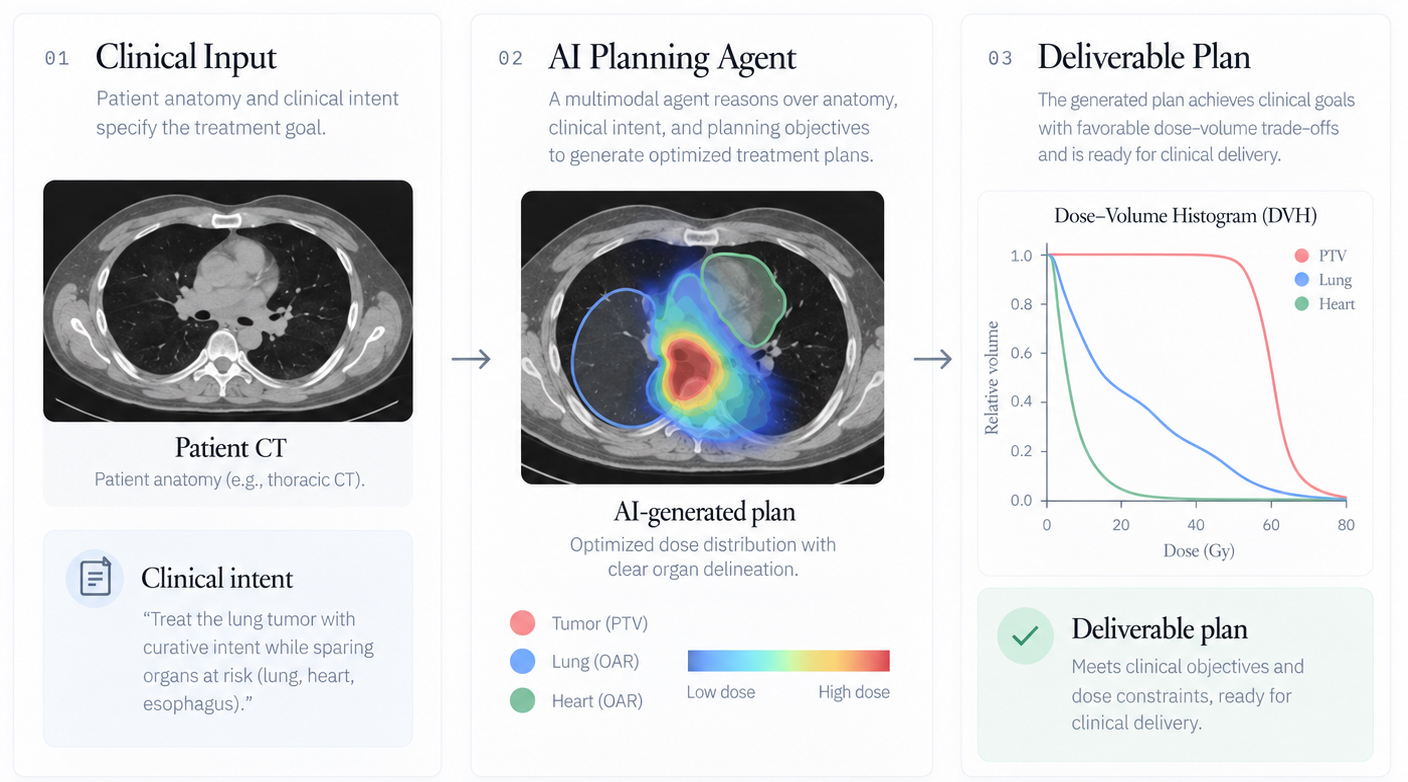 AI-guided radiotherapy